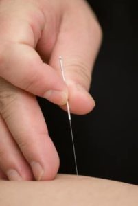The Benefits of Acupuncture & Chiropractic Care